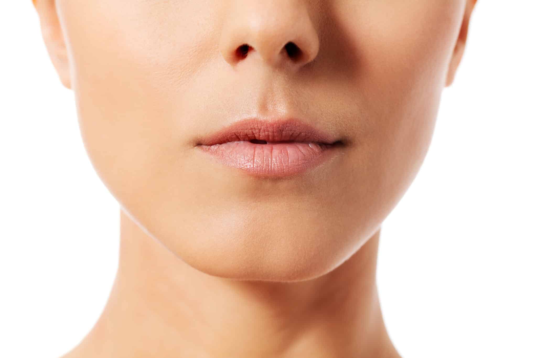 Lip Filler-Lip Augmentation