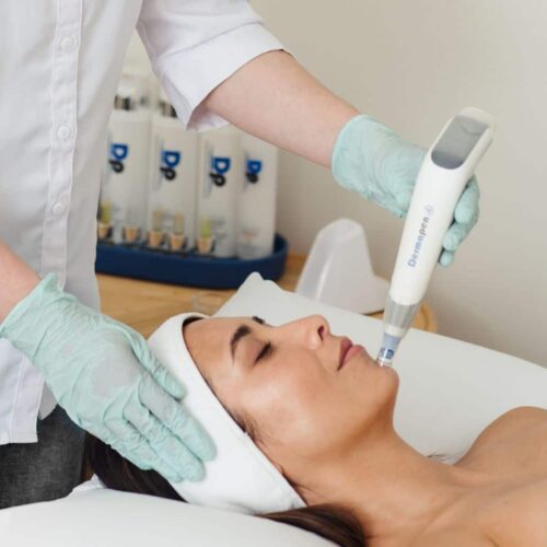 Microneedling Christchurch Packages
