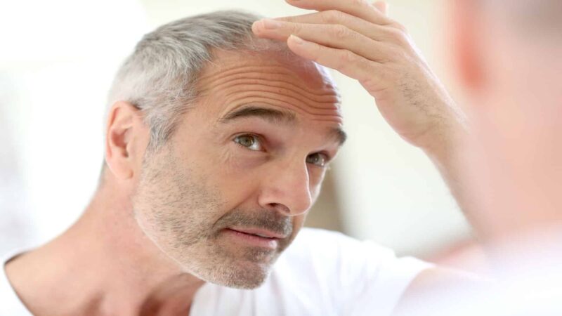 hair loss doctor near me