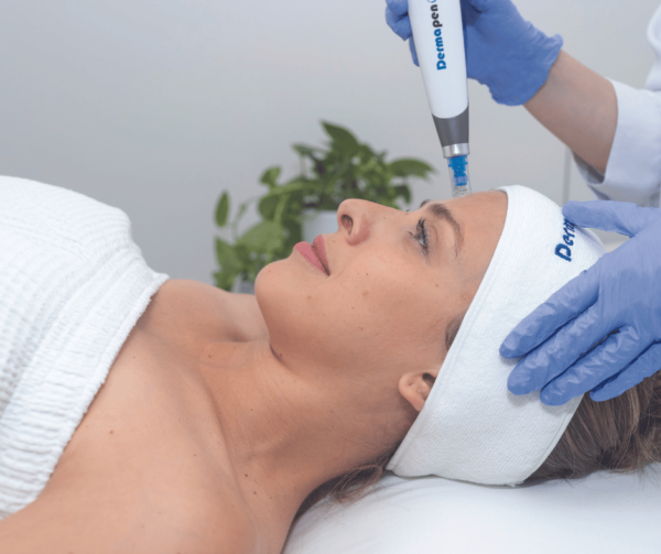 Microneedling with Dermapen 4 Christchurch