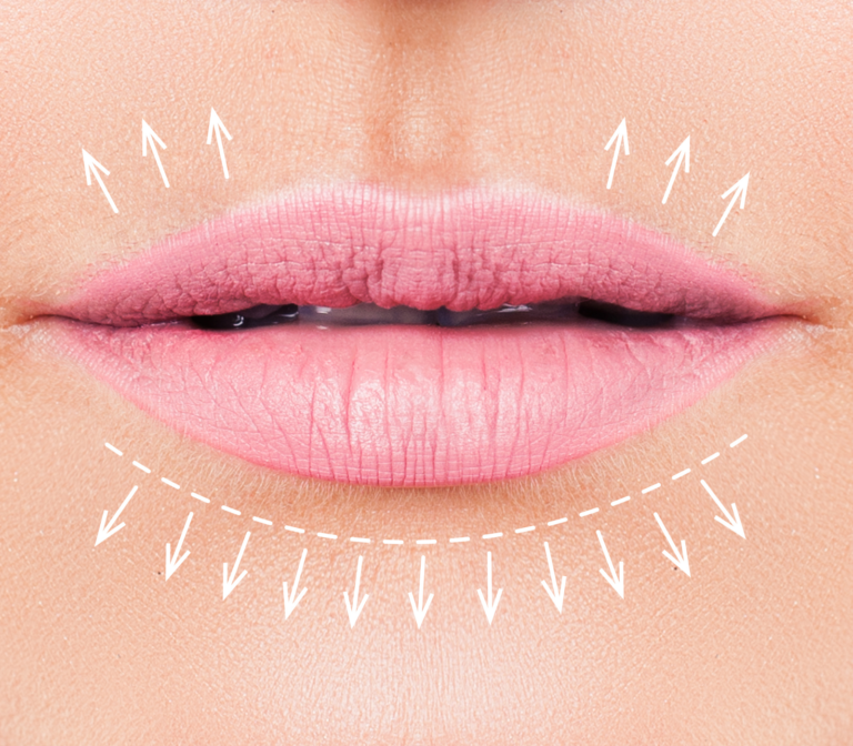 Lip Shapes: Understanding and Enhancing Your Natural Beauty