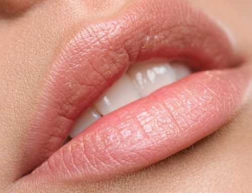 Botox For Lips-How Does it work