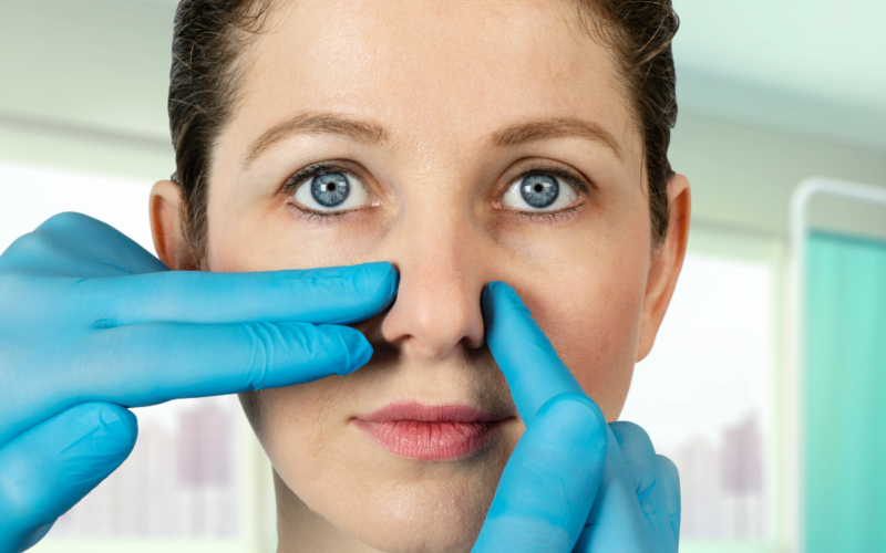 Preparing for a non-surgical nose lift