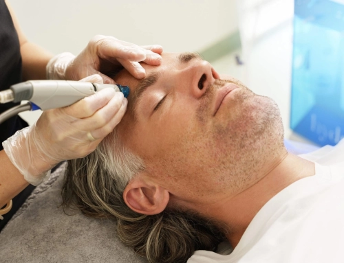 Using PRP Plasma to Enhance Hair Growth After a Hair Transplant for Men