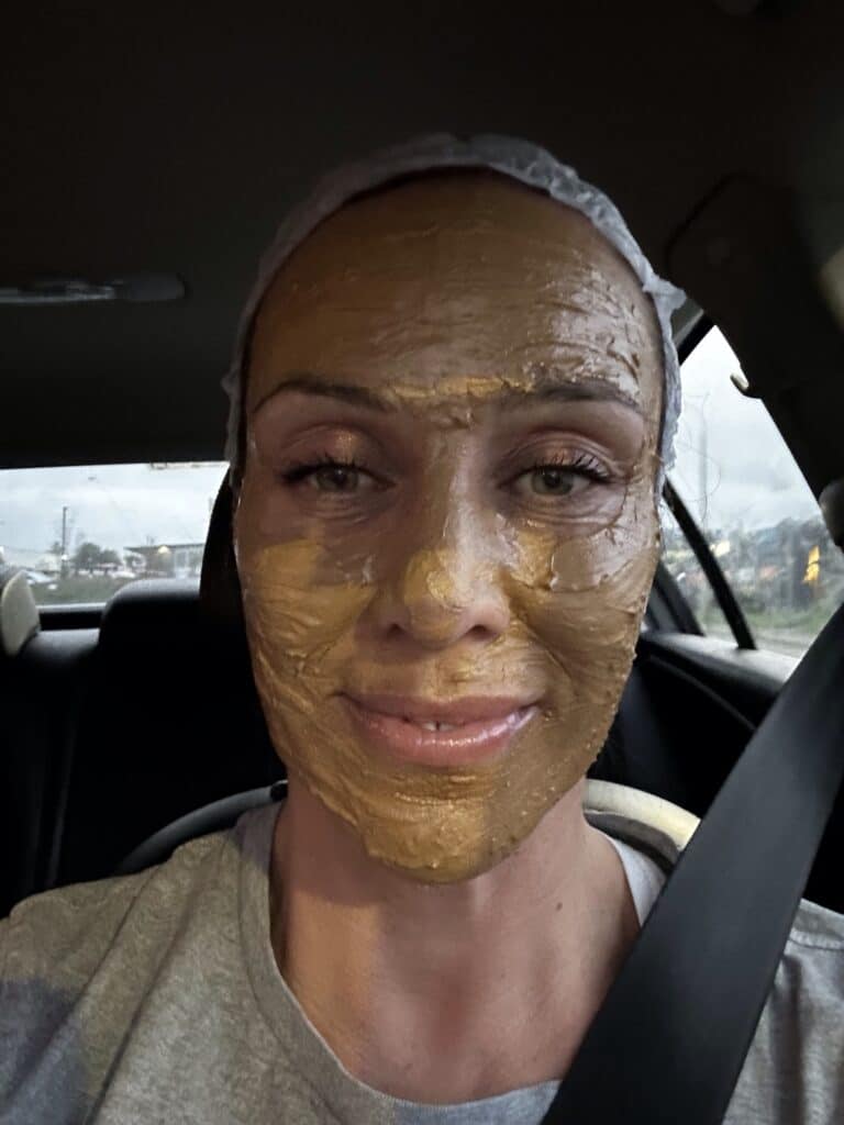 Jessie going home after her cosmelan mask