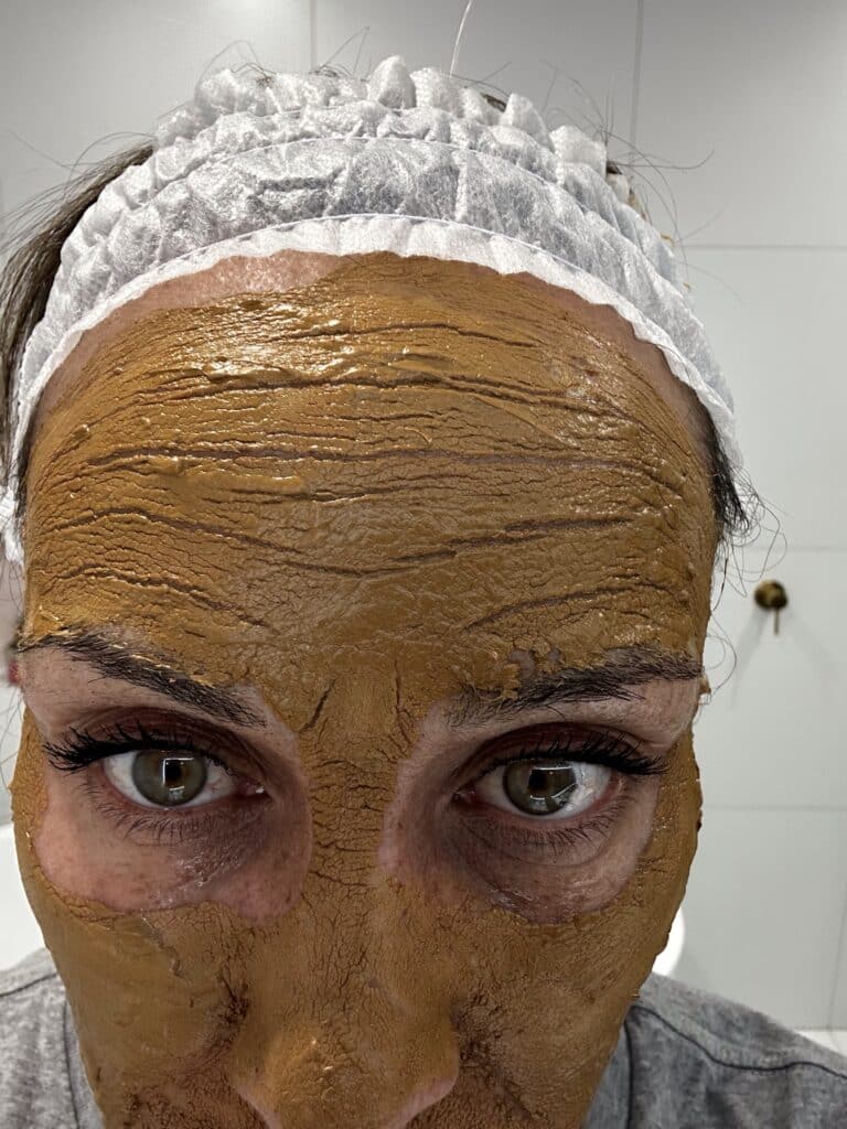 After the cosmelan mask