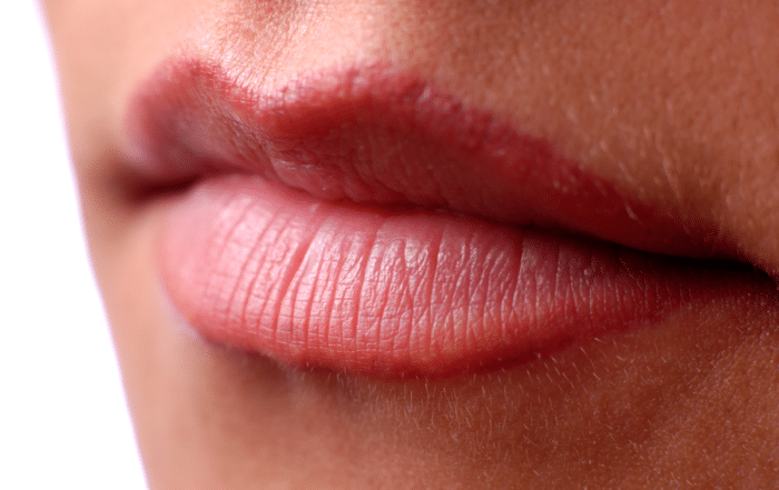 Natural Lips at Satini Cosmetic Clinic Christchurch