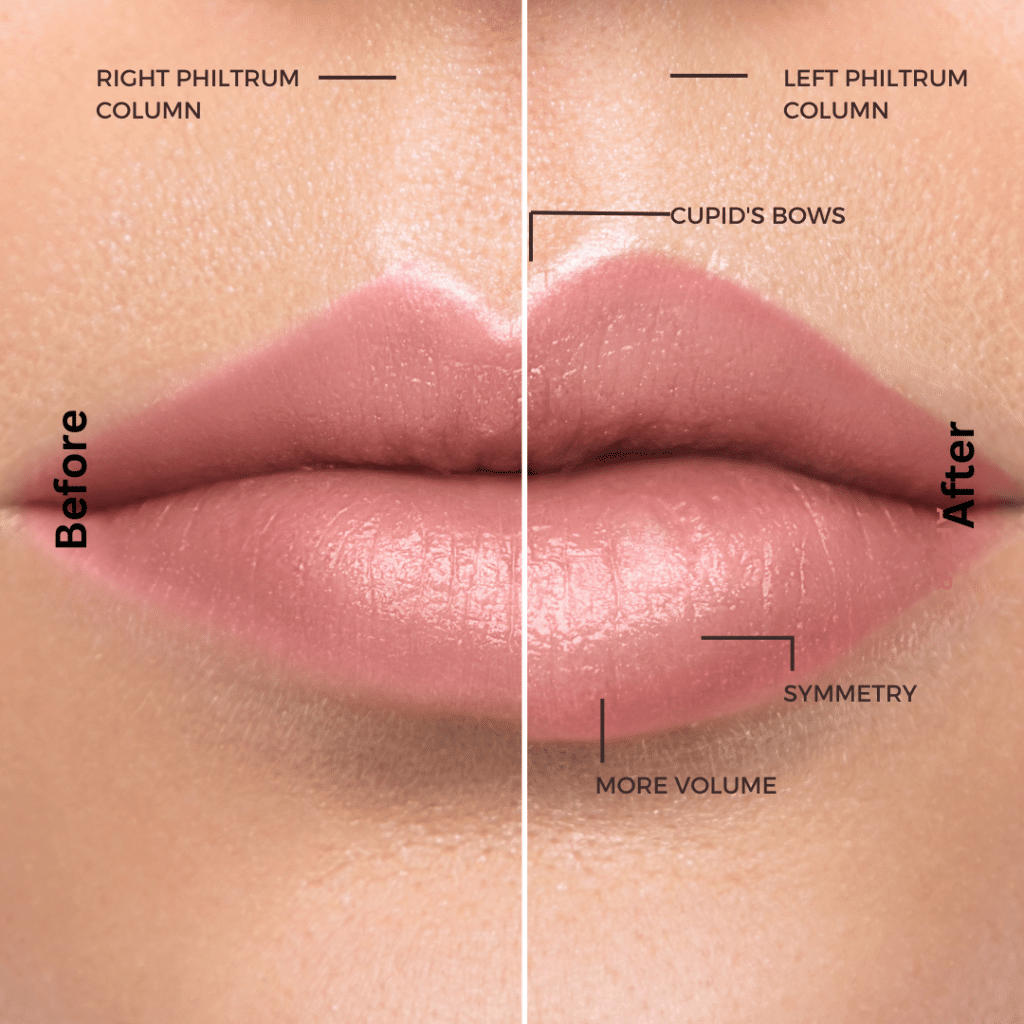 The lip shape and how it develops