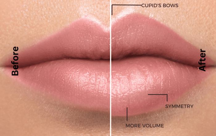 The lip shape and how it develops