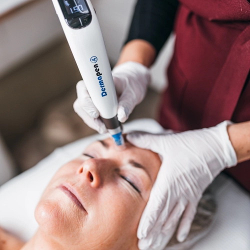 Dermapen microneedling