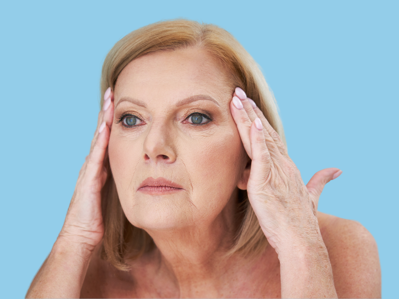 Mature woman before biostimulator treatment