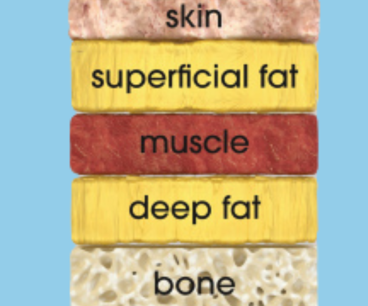 Layers of the skin including deep and superficial fat pads