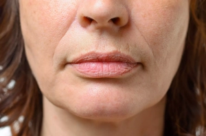 Nasolabial folds, mature woman