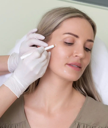 Juvelook at Satini Cosmetic Clinic in Christchurch-Model Juvelook at Satini Cosmetic Clinic in Christchurch-Model